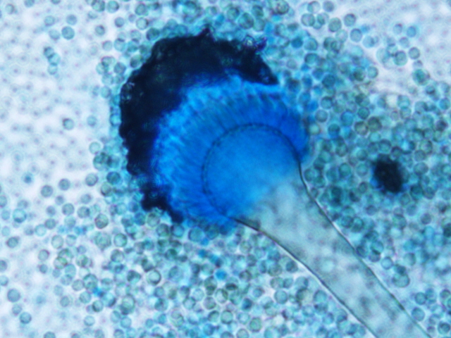 Soppen Aspergillus fumigatus i mikroskop