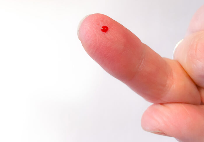 Finger med bloddråpe etter blodprøvestikk.