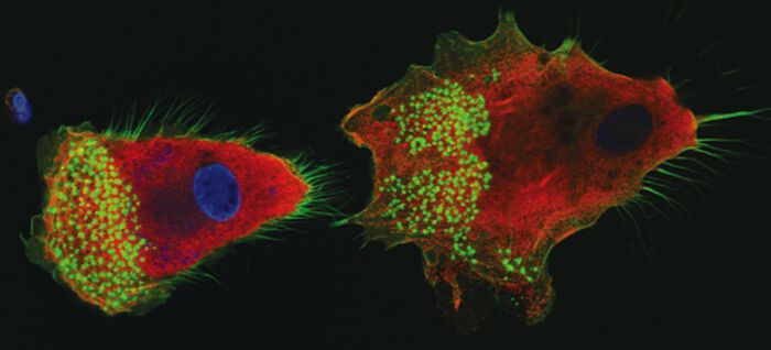 Her er to kreftceller i bevegelse. Ved hjelp av fluorescerende stoffer kan forskerne fargelegge ulike deler av cellen for å se hvordan de virker sammen. 